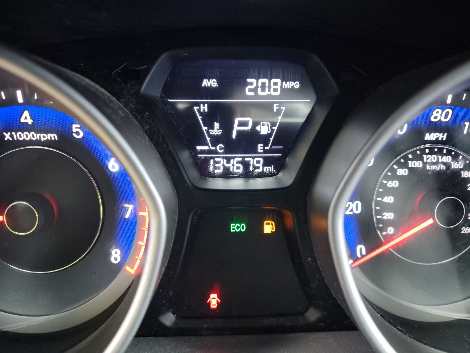 2016 Hyundai Elantra SE FWD